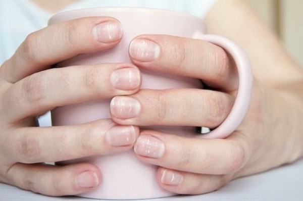 На ногтях появились белые полосочки. Это опасно?