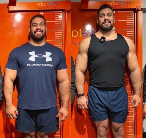 Мужчина потратил 100 тысяч евро, чтобы увеличить свой рост. «Вырос» до двух метров