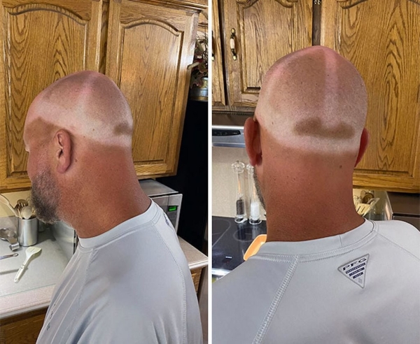 Эти фотографии показали, почему использовать солнцезащитный крем — хорошая идея!