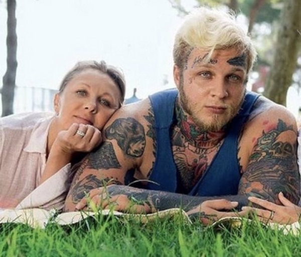 Как выглядит лицо после удаления татуировки