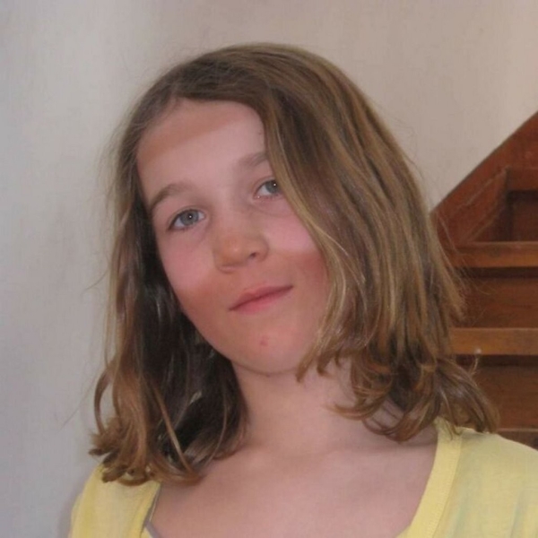 Эти фотографии показали, почему использовать солнцезащитный крем — хорошая идея!